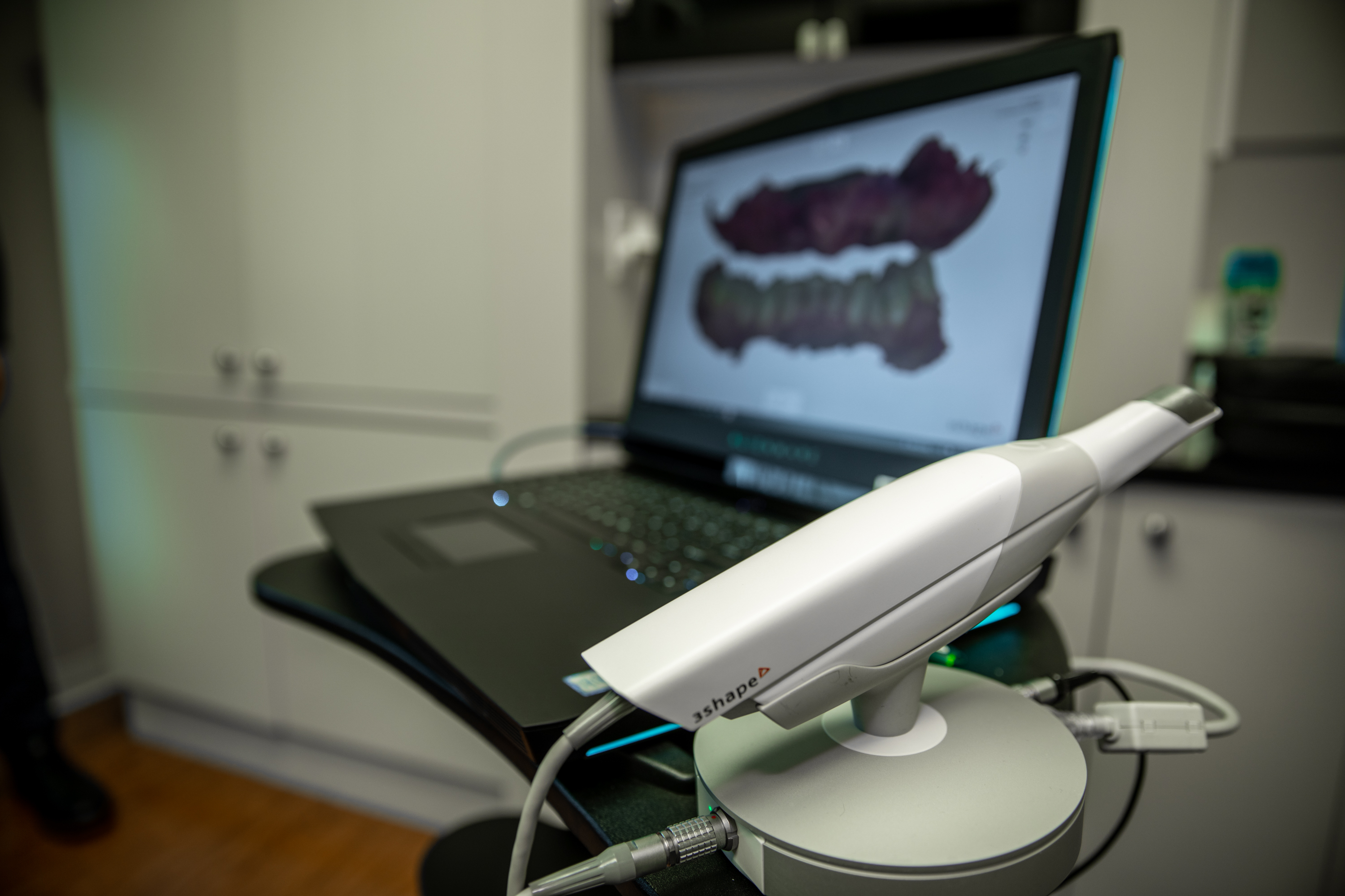 An intraoral scanner beside the digital model of a patient’s arch