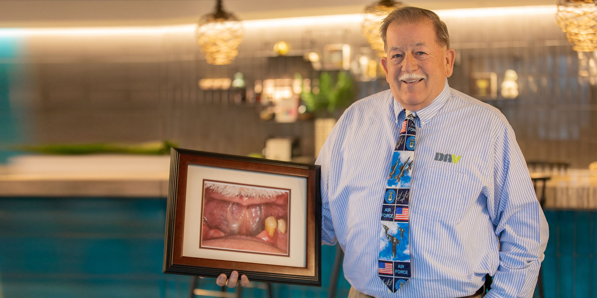 A patient holding a framed photograph of his mouth before implant treatment