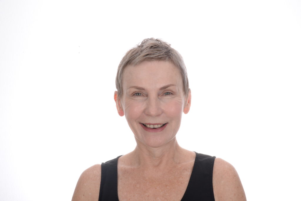 Before: smile makeover case 50