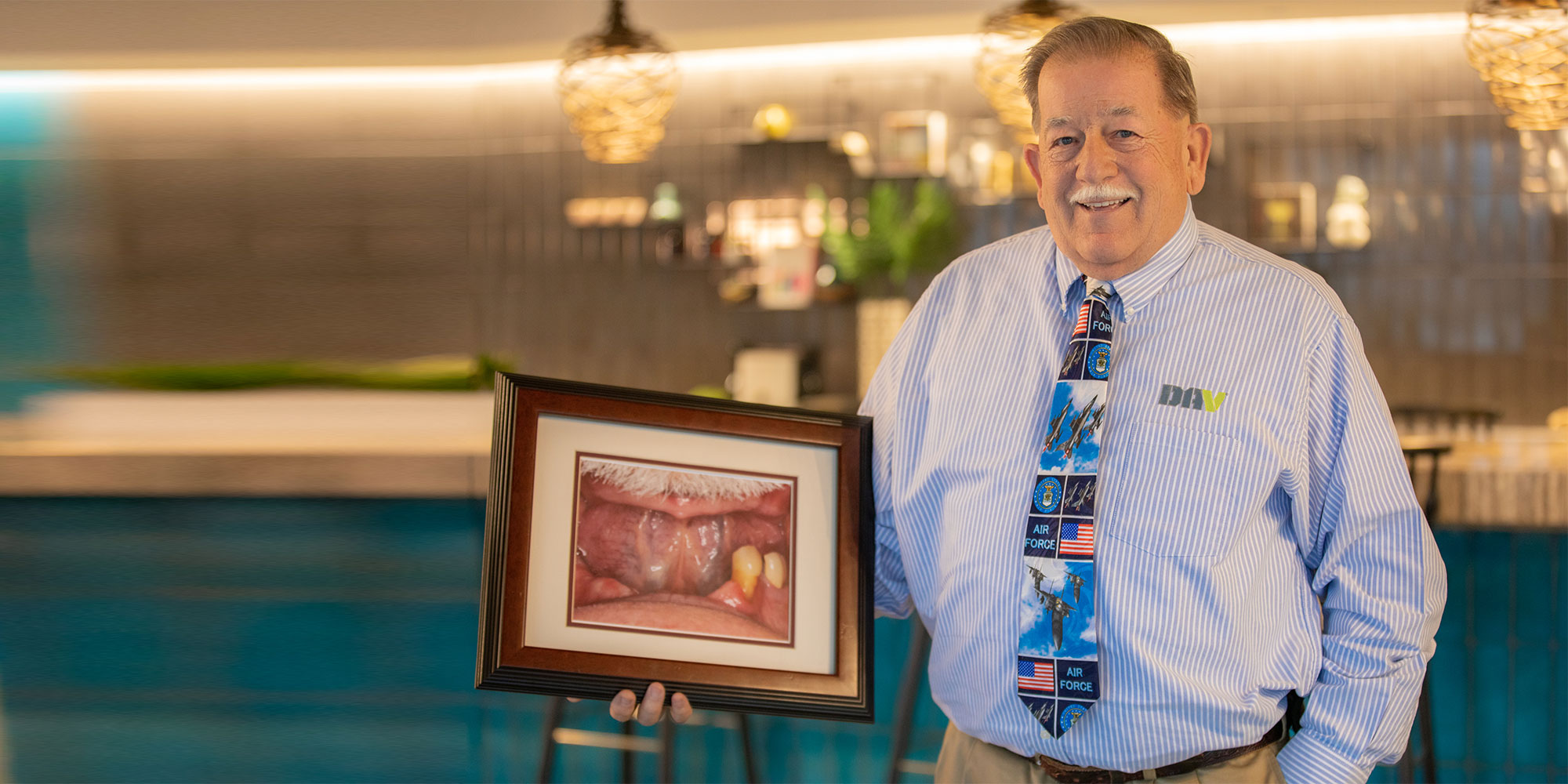 A patient holding a framed close-up photograph of his lower jaw before treatment