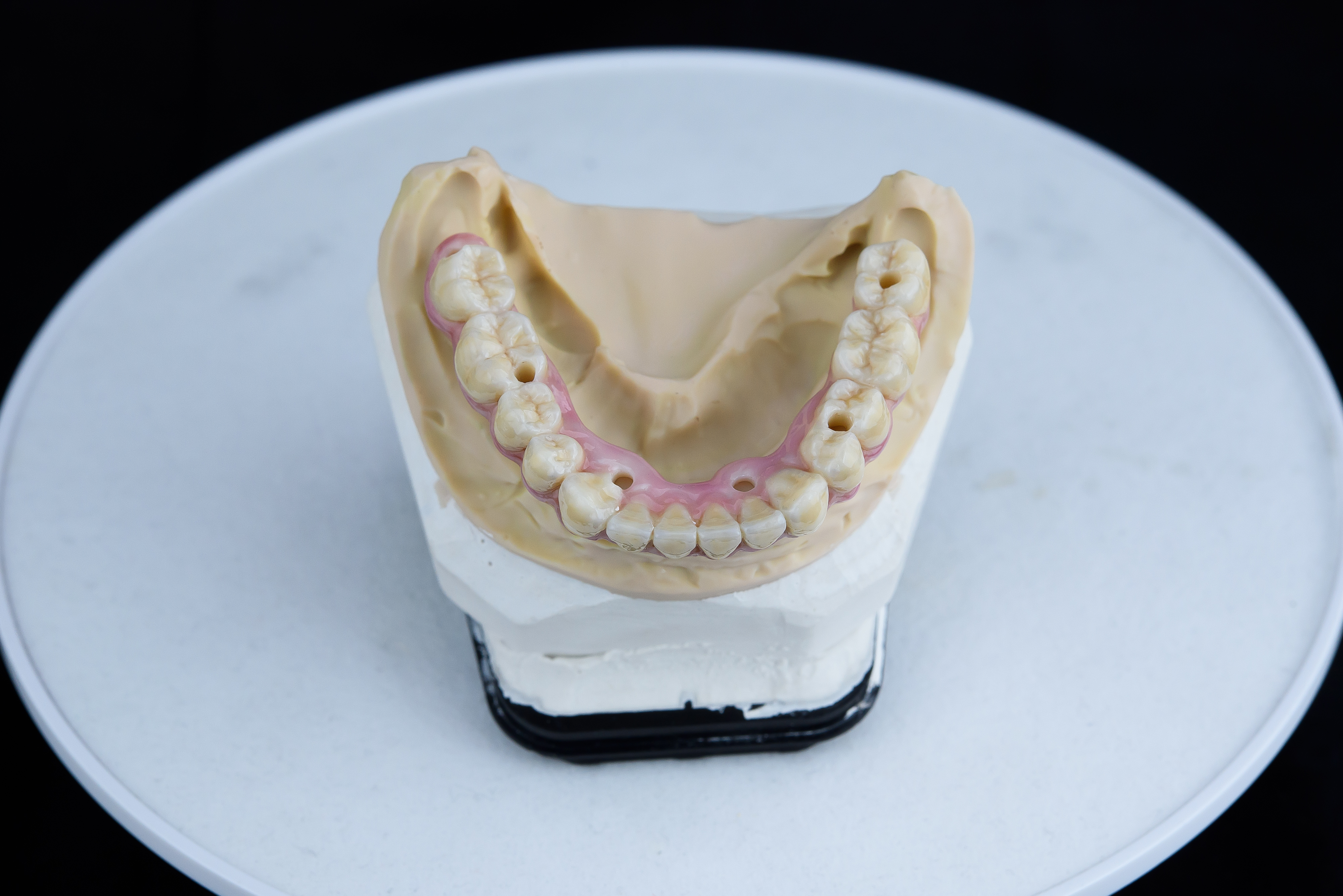 Teeth ceramics dentures on printed acrylic model in dental lab. Top view