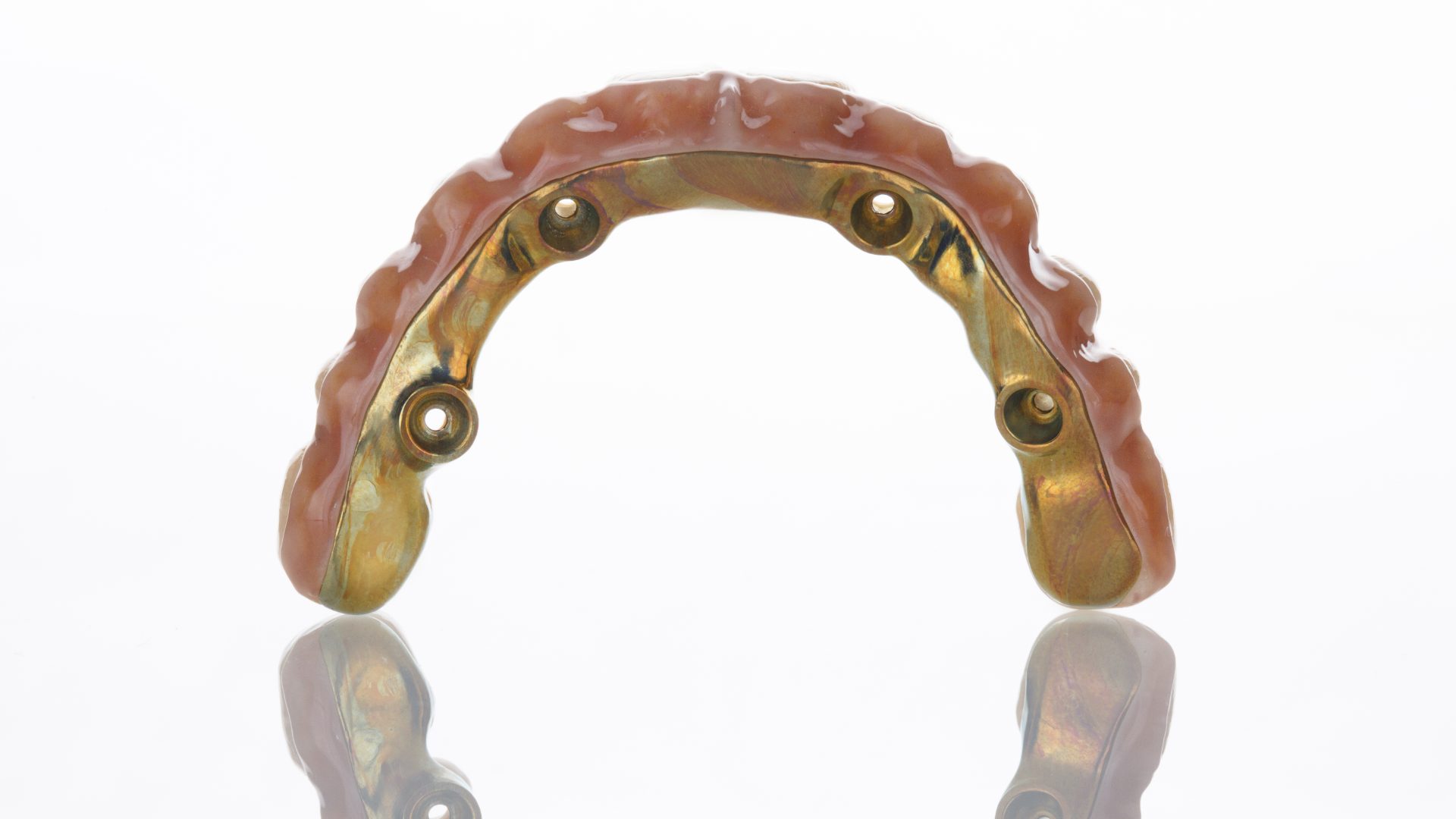 Underside of a full-arch implant bridge, showing its metal framework and four screw-access channels
